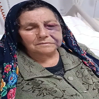 adana'da yaşlı bir kadın darp edildi